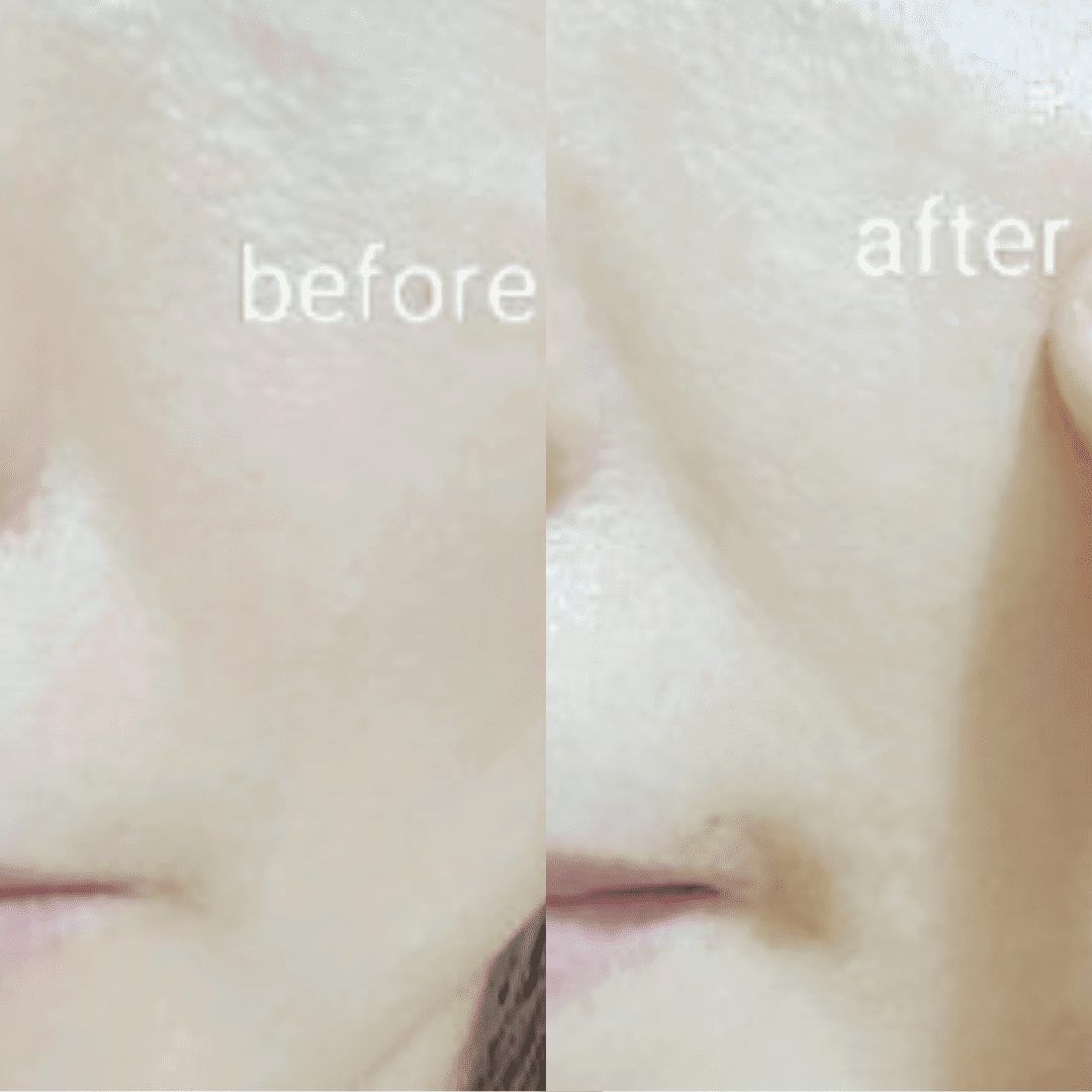 Ja Yeon Mapping Collagen Anti-Aging Mask (5 PCS)