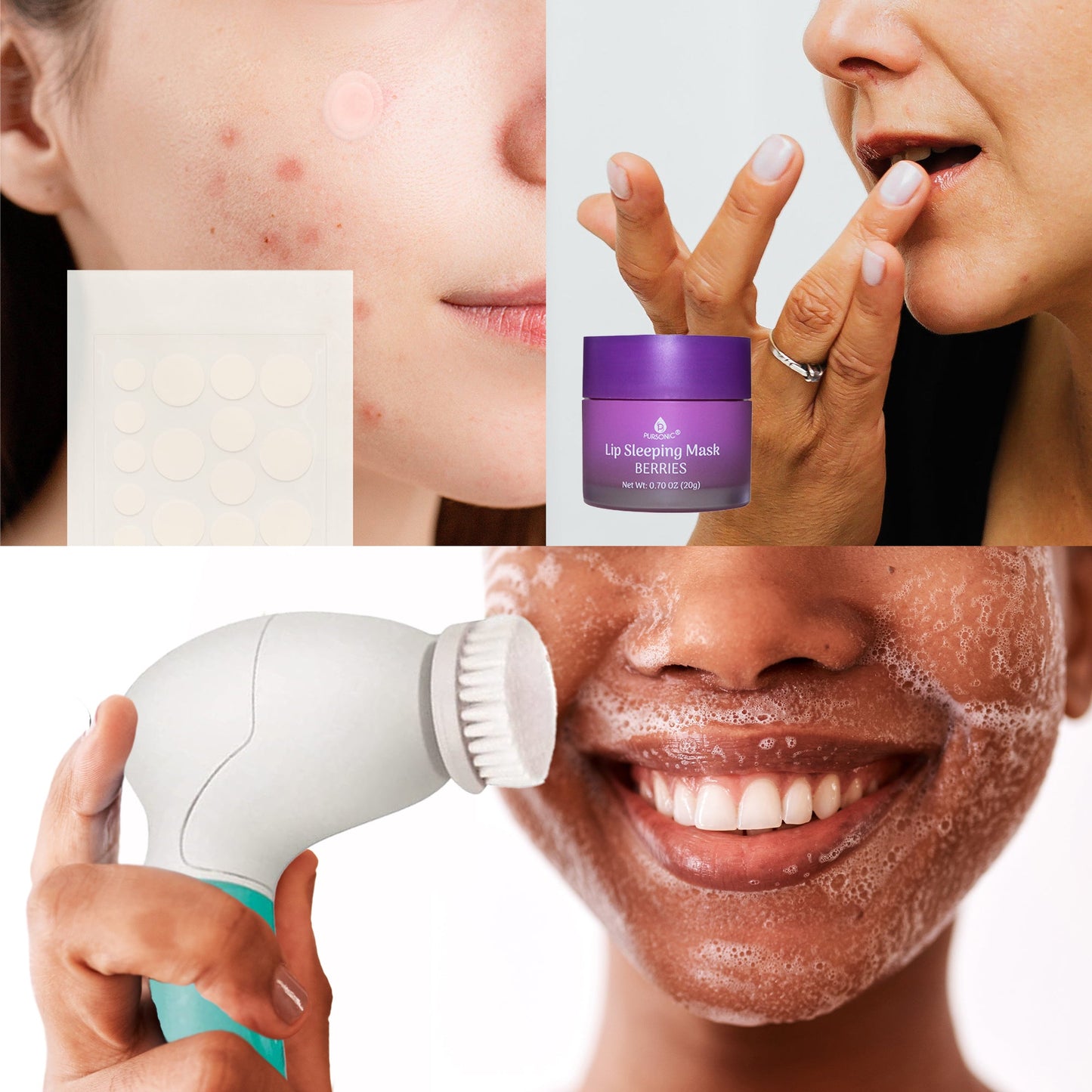 Ultimate Skincare Bundle: Lip Care, Acne Solution, and Advanced
