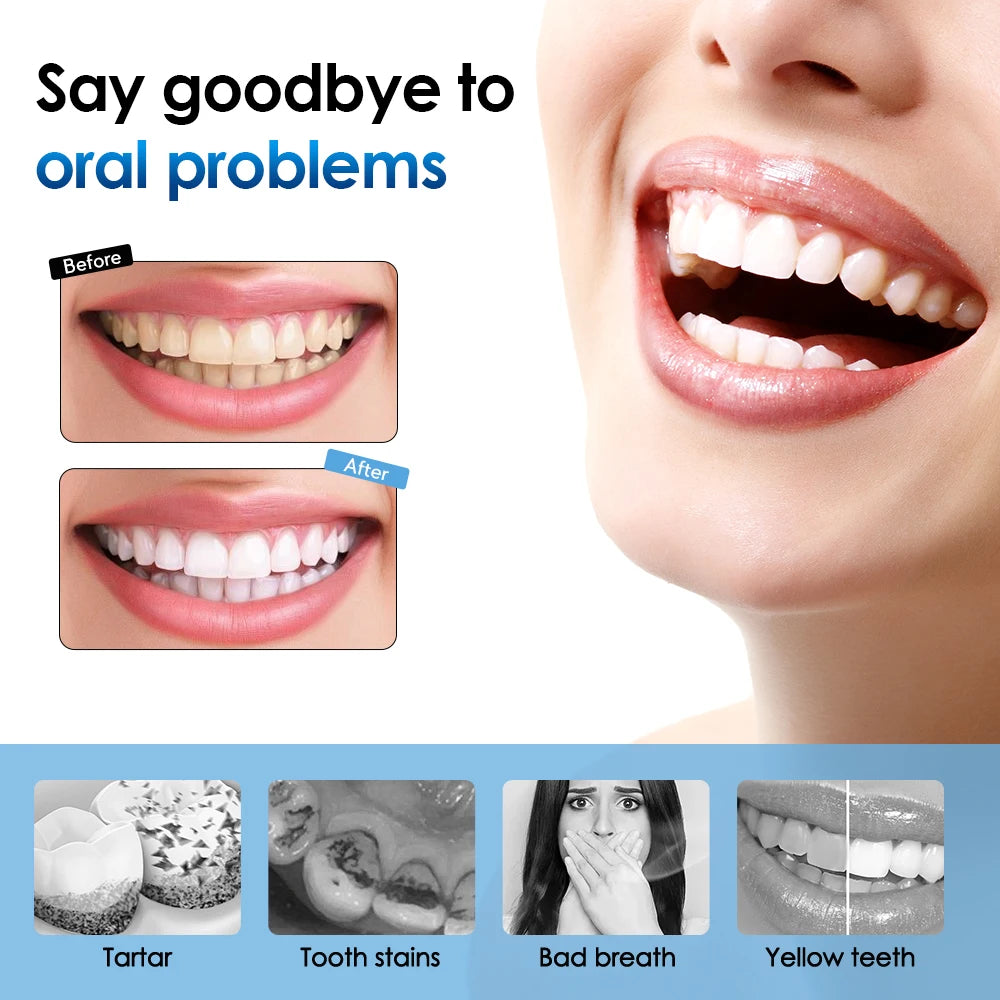 Electric Tooth Cleaner Waterproof Toothbrush Sonic Vibration Dental Scaler Plaque Calculus Tartar Remover Teeth Cleaning Tools