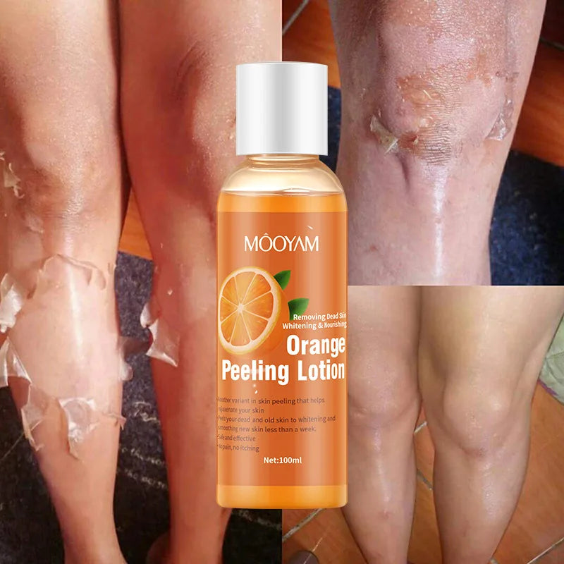 100ml Orange Peeling Oils For Dark Skin Moisturizing Foot Exfoliator Body Scrub Elbow Knee Peeling Oil  Body Skin Care Products