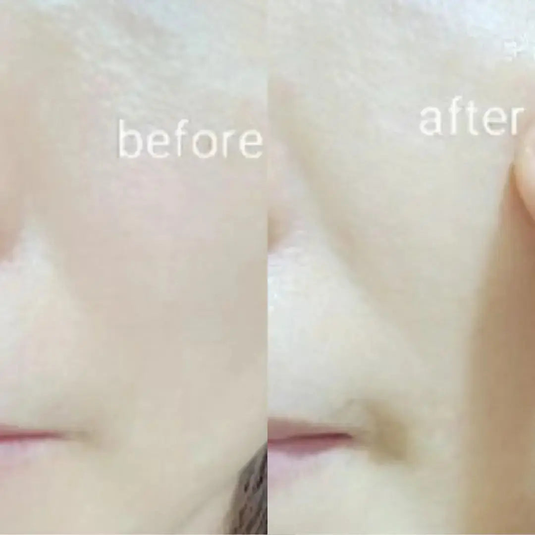 Ja Yeon Mapping Collagen Mask - 100 Units