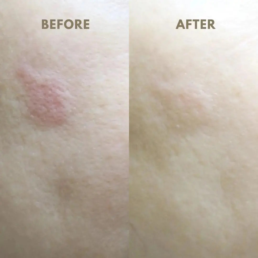 Ja Yeon Mapping Collagen Mask - 100 Units