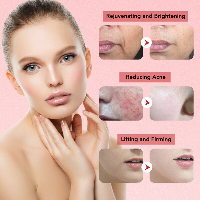 7 In 1 RF Face Massager Skin Rejuvenation Mesotherapy Facial Lifting