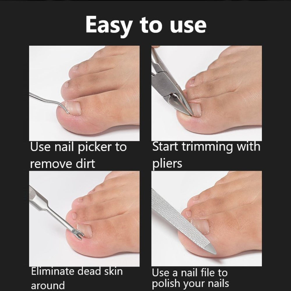 Dead Skin Dirt Remover Pedicure Care Tool Pro