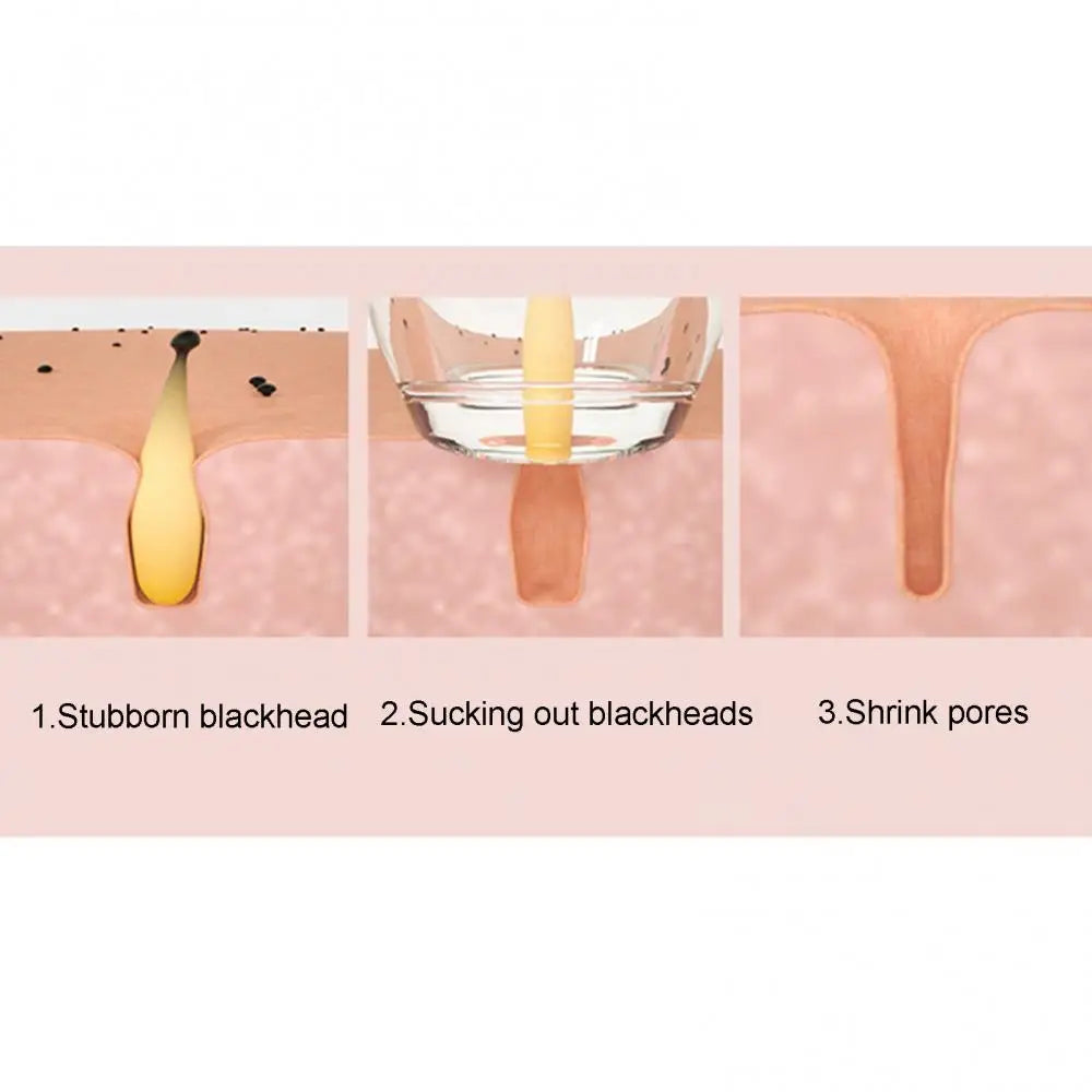 Blackhead Remover Pore Vacuum Cleaner Face Skin Care Sucker