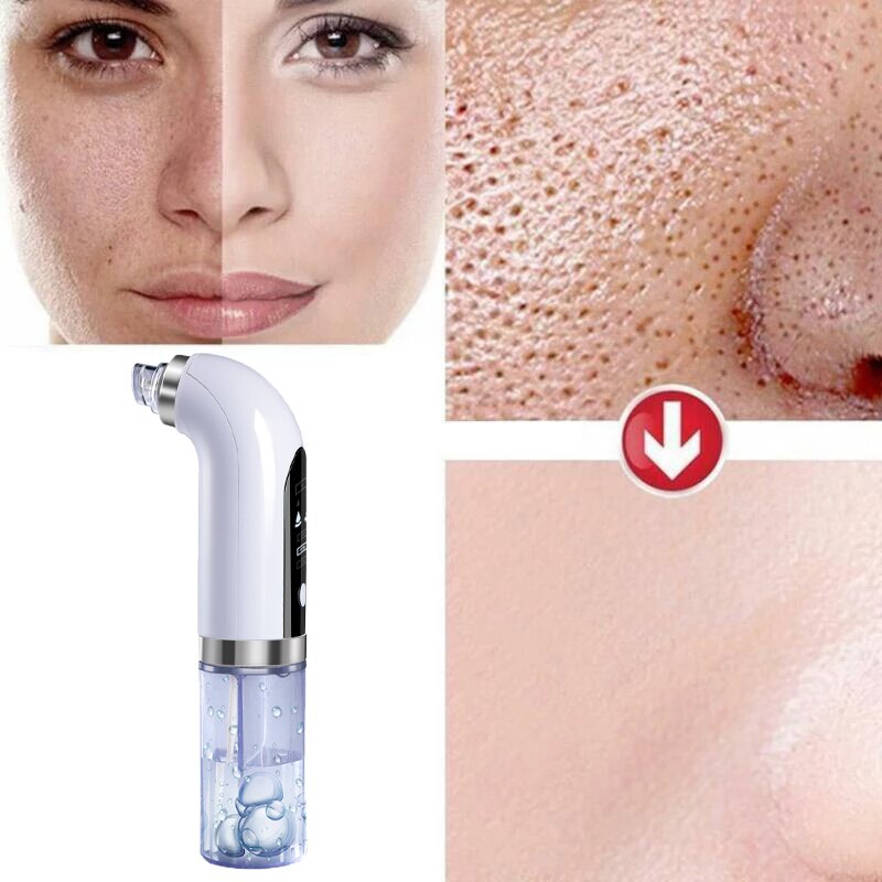 Small Bubble Blackhead Remover Vacuum Nose Pore Cleaner with USB