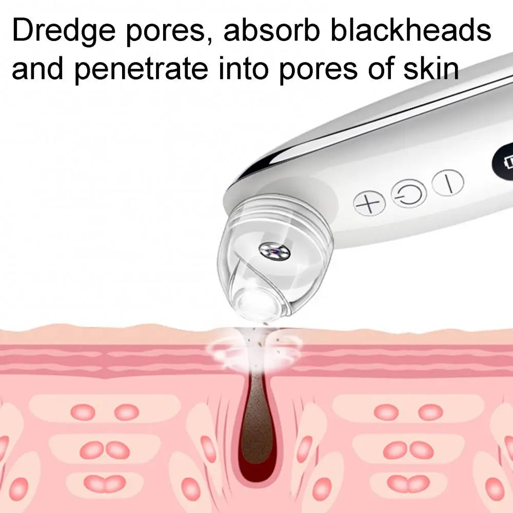 Blackhead Remover Pore Vacuum Cleaner Face Skin Care Sucker