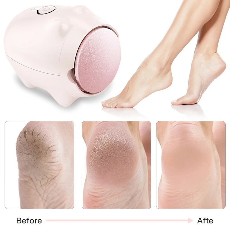 New Electric Foot Grinder for Removing Dead Skin Cocoon Cuticle Layer