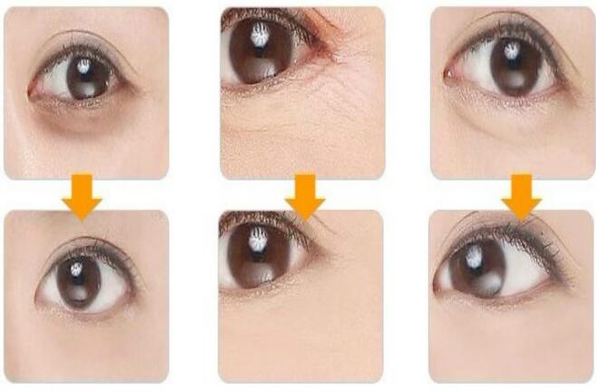 Crystal Collagen Gold Eye Mask Golden Mask stick to dark circles Eye